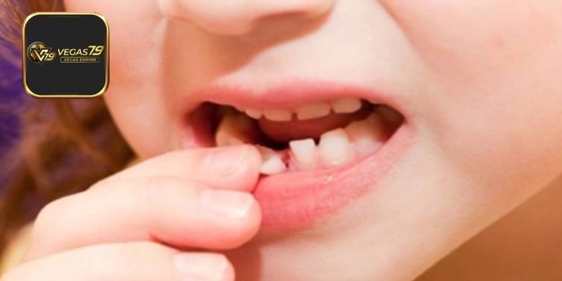 Giải mã 5 giấc mơ thấy rụng răng