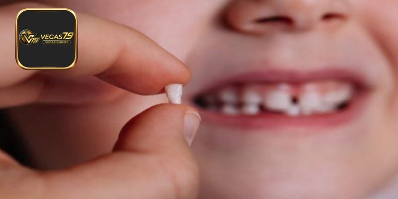 Lý giải thông điệp mơ thấy rụng răng ở bạn thân